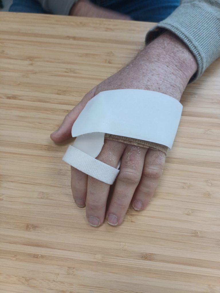 Handig Advies - Handtherapie