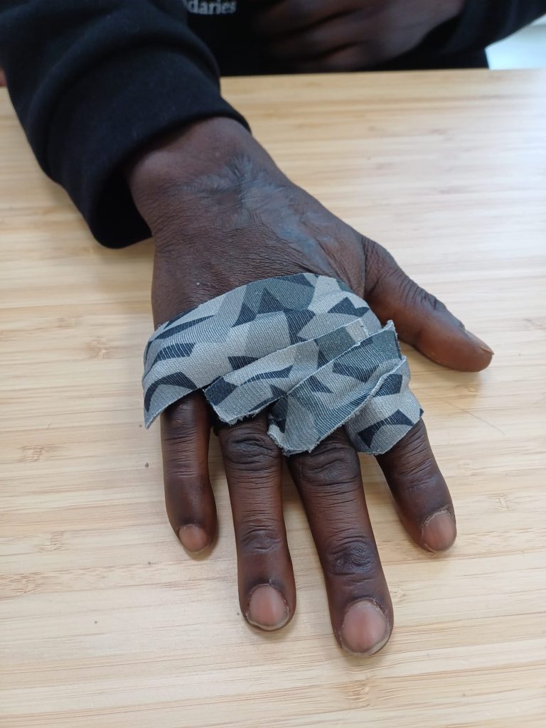 Handig Advies - Handtherapie
